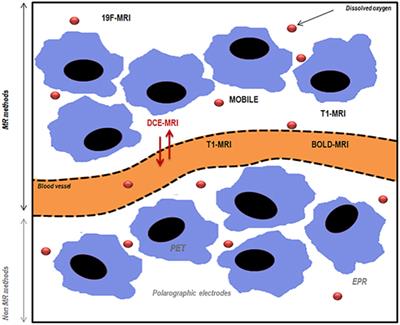 Assessing Tumor Oxygenation for Predicting Outcome in Radiation Oncology: A Review of Studies Correlating Tumor Hypoxic Status and Outcome in the Preclinical and Clinical Settings
